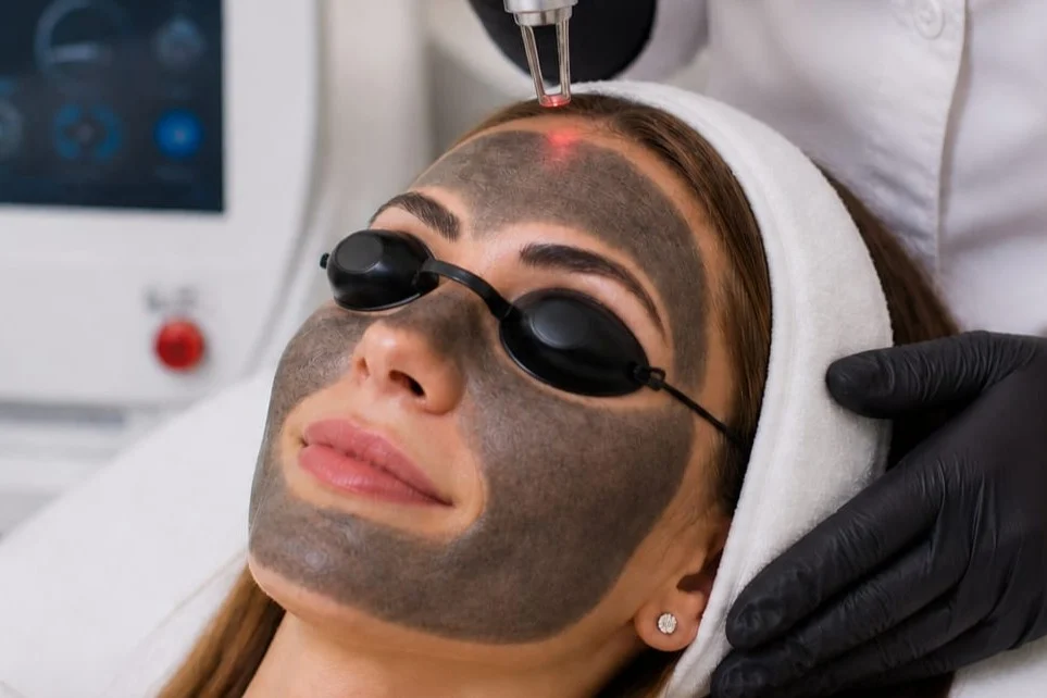 YG-Carbon-Laser-Peel-New-1